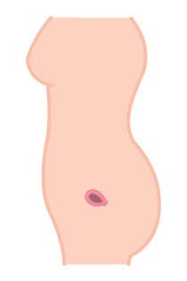 Pregnancy illustration - 1st month